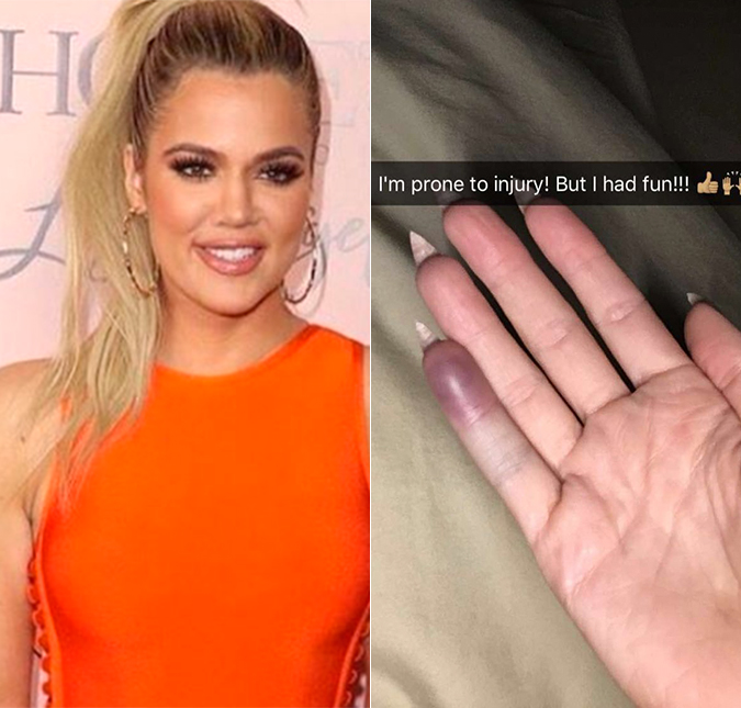 Khloé Kardashian lesiona dedo após comemorar aniversário, veja!