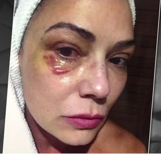 Luiza Brunet fala sobre caso de agressão: - <i>Tive medo de denunciar, tive vergonha</i>