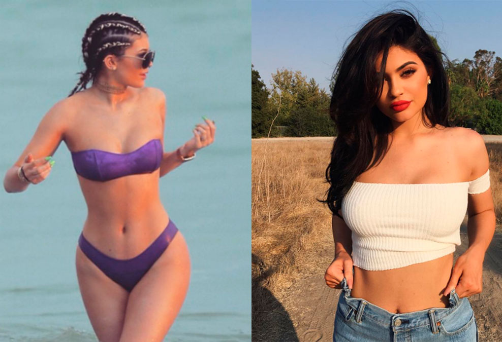 Kylie Jenner teria colocado silicone, diz <i>site</i>!