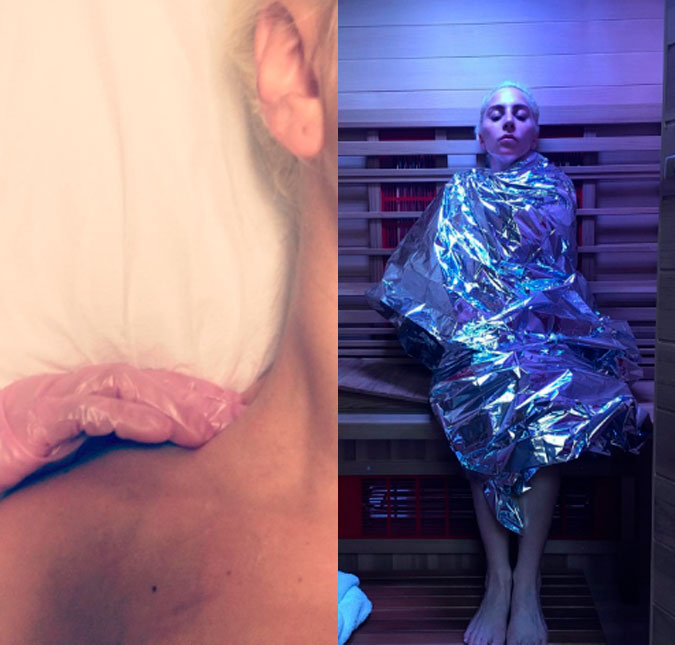 Lady Gaga revela que sofre de dores crônicas e recebe apoio de seguidores, saiba mais!