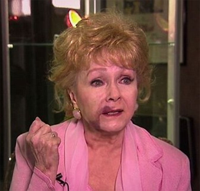 Debbie Reynolds tinha sofrido queda e ficado com hematoma no rosto antes de morrer