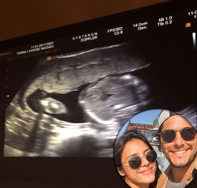 Bruno Gissoni baba no ultrassom da filha com Yanna Lavigne