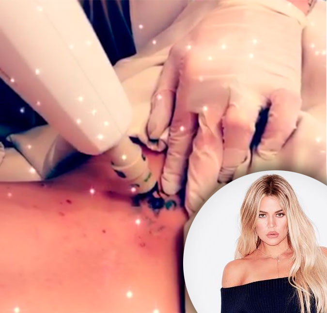 Khloé Kardashian passa por mais uma sessão de remoção de tatuagem, entenda!