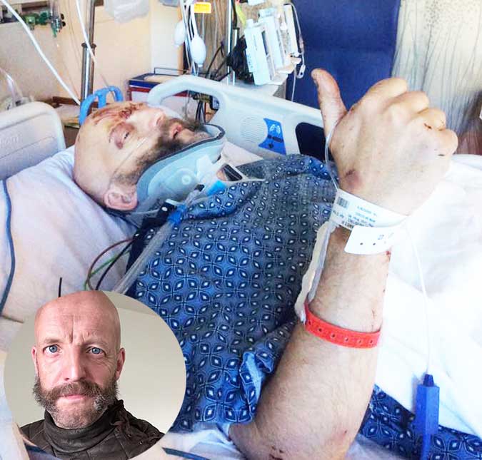 Ator de <i>Harry Potter</i> sofre grave acidente de carro e aparece em foto no hospital