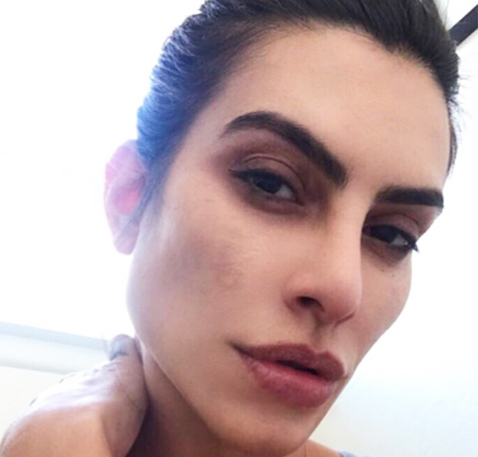 Cleo Pires desabafa sobre doença na pele: - <i>Foi difícil para mim</i>