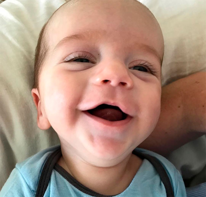 Filho de Jimmy Kimmel é só sorrisos após passar por cirurgia, saiba mais!