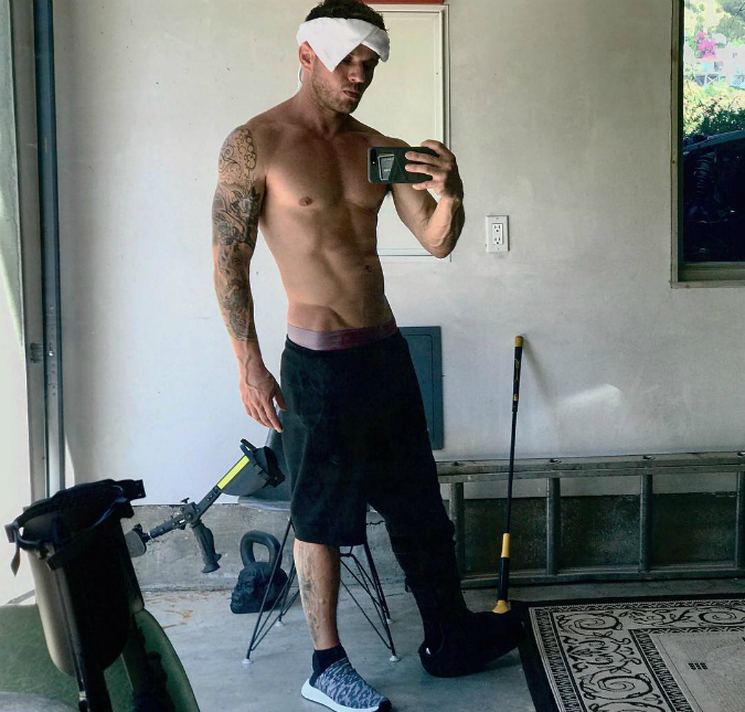 Ryan Phillippe exibe corpo malhado após acidente em que quebrou a perna, confira!