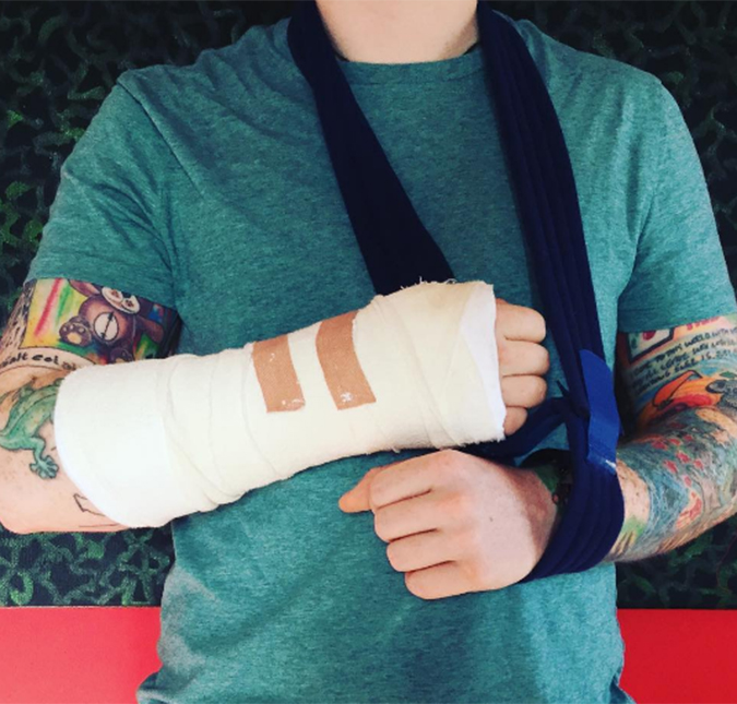 Ed Sheeran quebra o braço após acidente com bicicleta