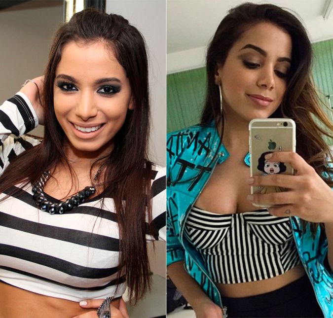A intervenção, a princípio, pretendia corrigir o desvio de septo causado por uma rinoplastia anterior. Mas já que estava lá, ela aproveitou para aperfeiçoá-lo e ficar com nariz de rica, em suas próprias palavras.