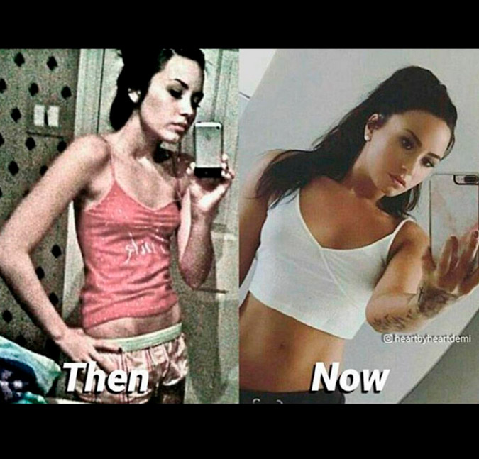 Demi Lovato mostra um antes e depois chocante de seu corpo, veja!