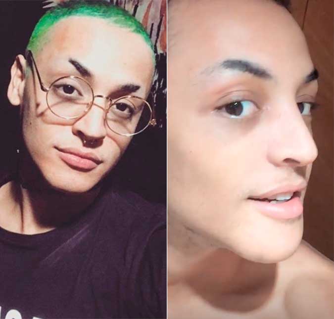Pabllo Vittar mostra resultado de cirurgias no nariz: <I>Ficou bafo!</i>