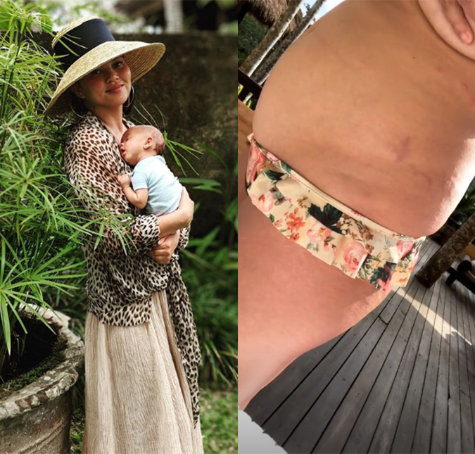 Chrissy Teigen mostra estrias após dar à luz: - <i>Este é meu novo corpo</i>