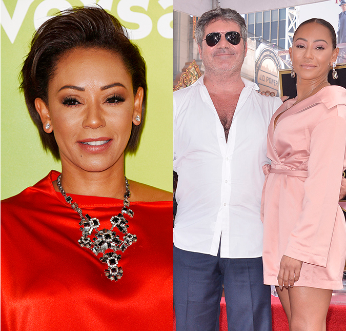 Mel B exibe rosto mais fino após <i>lifting</i> facial avaliado em 21 mil reais
