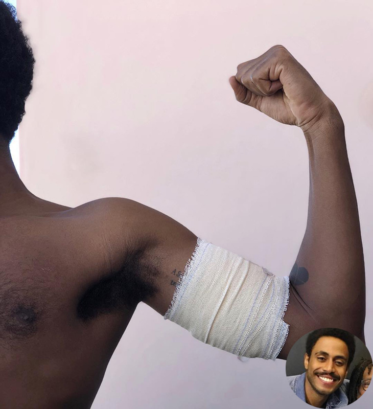 Após ser atingido por estilhaço de bala perdida, Ícaro Silva desabafa: <i>Muito feliz por não ter morrido</i>