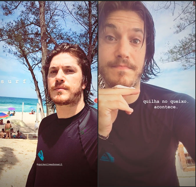 Caio Paduan se machuca enquanto surfa e compartilha ocorrido com seguidores: <i>Acontece</i>