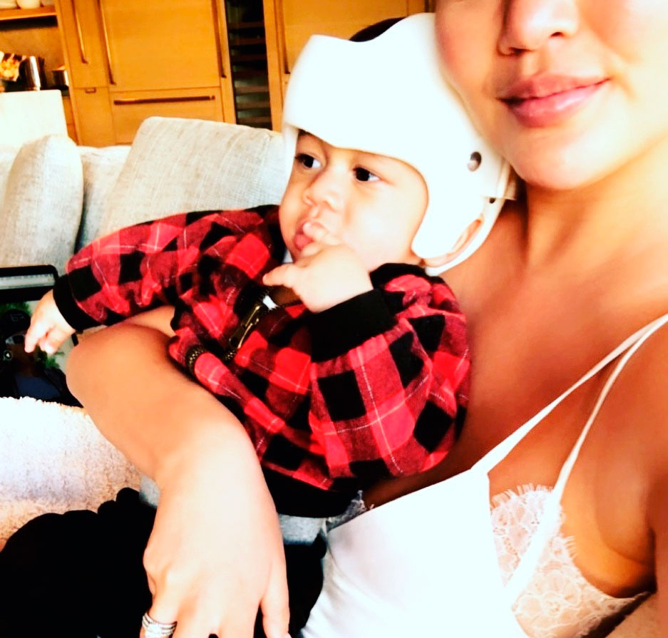 Filho de Chrissy Teigen e John Legend, de seis meses de idade precisa usar capacete