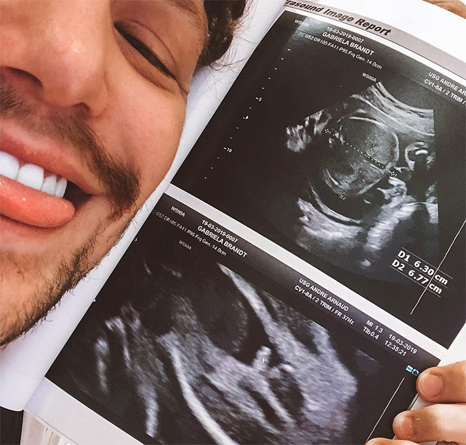 Saulo Pôncio mostra ultrassom do filho e gera polêmica com comentário: <I>Puxou ao pai</i>