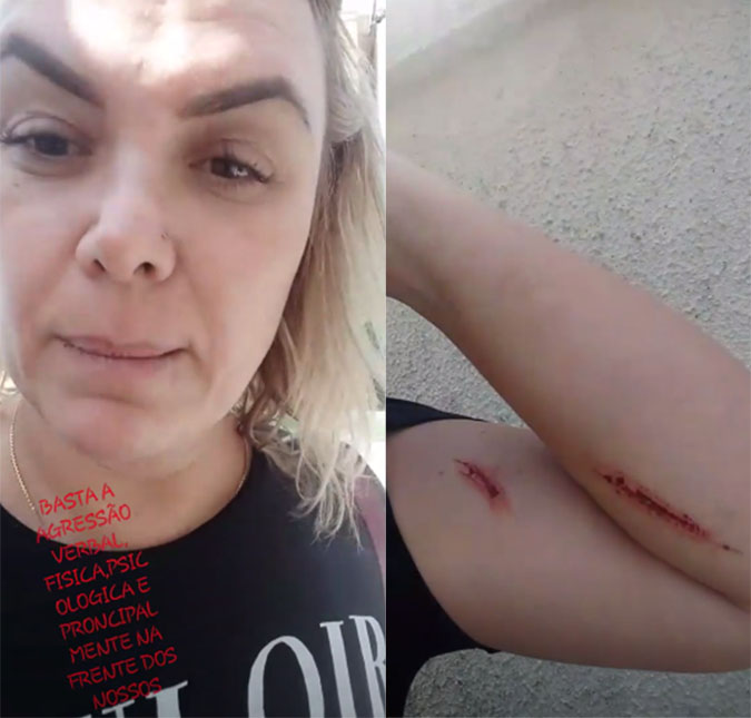Ex-paquita Ana Paula Almeida, a Pituxita, relata agressão do marido: <i>- Quis tornar isso público</i>
