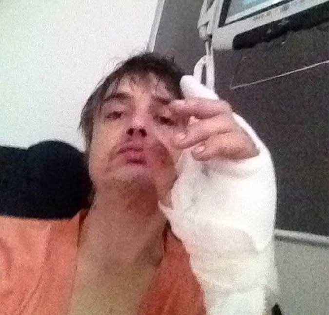 Roqueiro Pete Doherty vai para o hospital após ser espetado por porco-espinho ao salvar seu cachorro