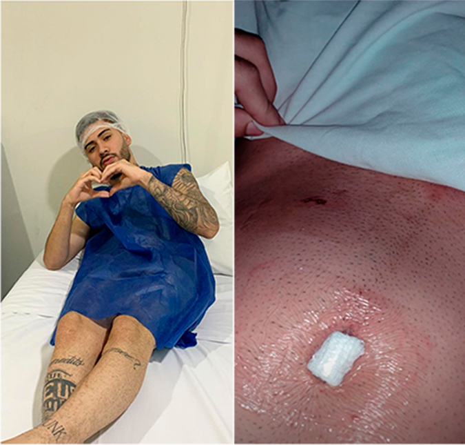 Após passar por cirurgia, Kevinho posta foto de curativo