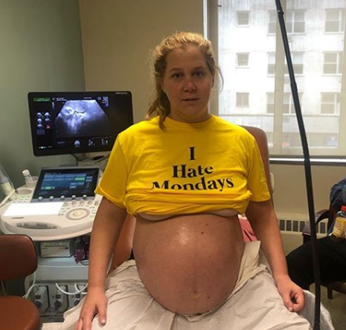 Amy Schumer brinca com o final da gravidez: <i>Deve ser irritante para todos</i>