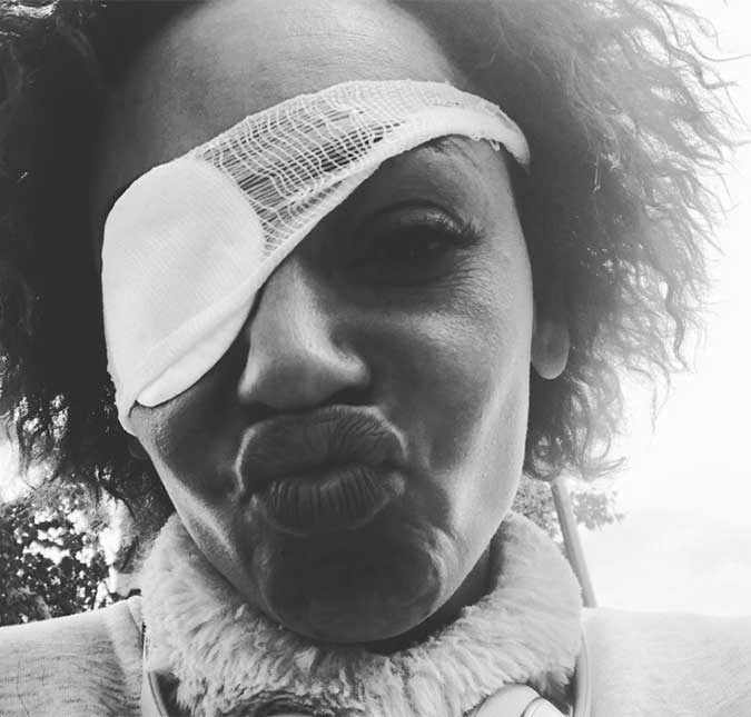 Mel B aparece com tampão no olho após cegueira temporária