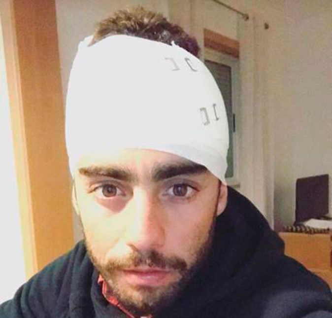 Mas apesar de suas conquistas no surfe, Scooby também já deu um grande susto em seu público por se arriscar na profissão. Em 2017, ele sofreu um grave acidente enquanto pegava onda em Nazaré, em Portugal. Ele foi retirado às pressas do mar para ser atendido pelos paramédicos. Scooby levou 20 pontos na cabeça ao sofrer um corte profundo depois que a prancha bateu em sua cabeça. Em 2013, Maya Gabeira sofreu um acidente no mesmo local. A colega de Scooby, que também pega ondas gigantes, chegou a ficar desacordada após o impacto da onda, sendo levada para o hospital depois de ser reanimada na areia.