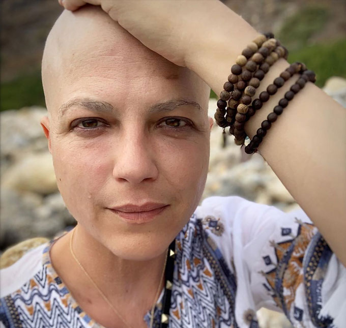Selma Blair impressiona ao mostrar resultado de tratamento contra esclerose múltipla