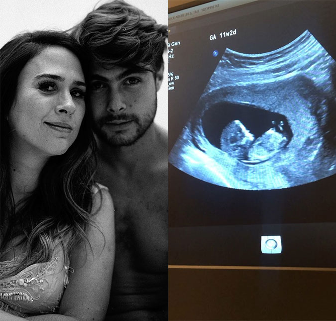 Tatá Werneck compartilha vídeo de ultrassom da filha e bebê <I>pula</I> no útero ao ouvir possível nome; assista!