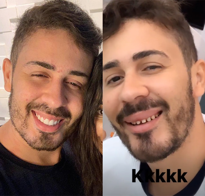 Carlinhos Maia surpreende ao mostrar o seu sorriso natural, compare!