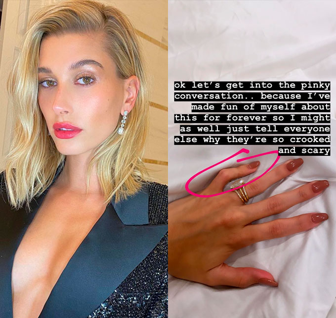 Hailey Bieber revela ter dedos tortos por conta de distúrbio genético e pede: <i>Parem de zoar</i>