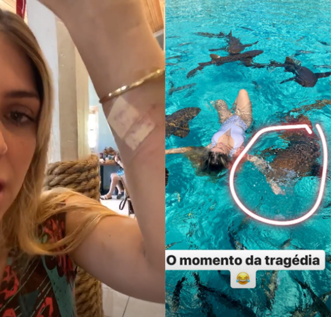 Blogueira é mordida enquanto nadava com tubarões: <i>- Arrancou um pedaço do meu braço</i>