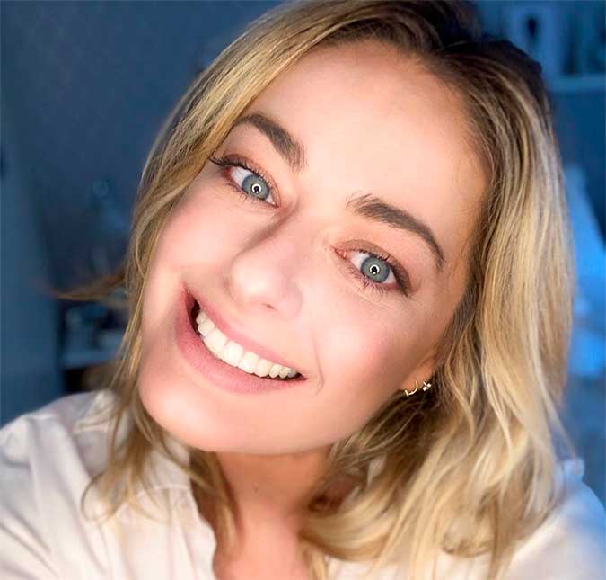 Campeã do <i>Masterchef 2018</i>, Maria Antonia Russi sofre acidente e posta foto chocante em seu <i>Instagram</i>; veja!