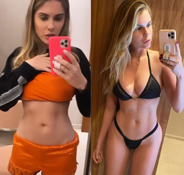 Após cirurgia, Bárbara Evans fala sobre recuperação e exibe a barriga: <i>-Está ainda bem inchado e bastante dolorido</i>