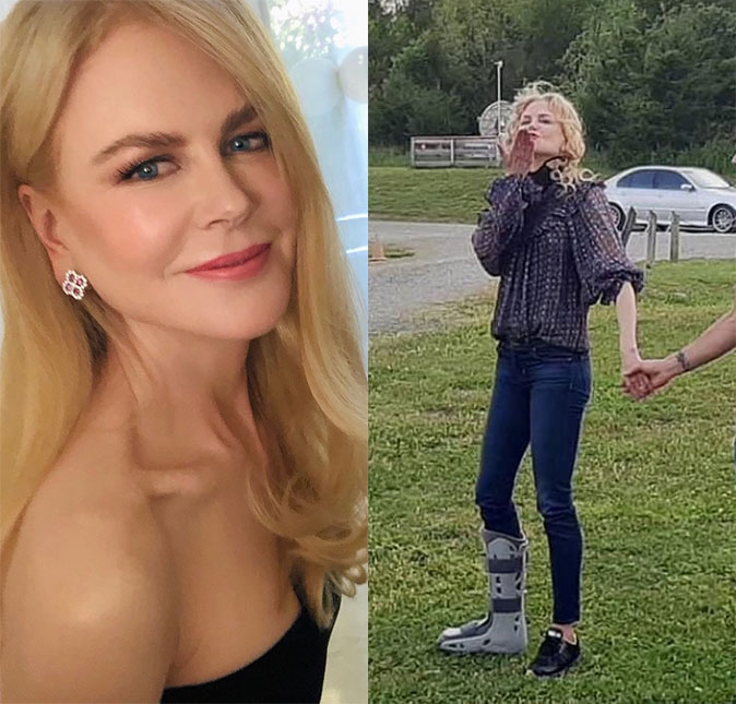 Nicole Kidman aparece usando bota ortopédica e Keith Urban diz: <i>Ela é uma guerreira</i>