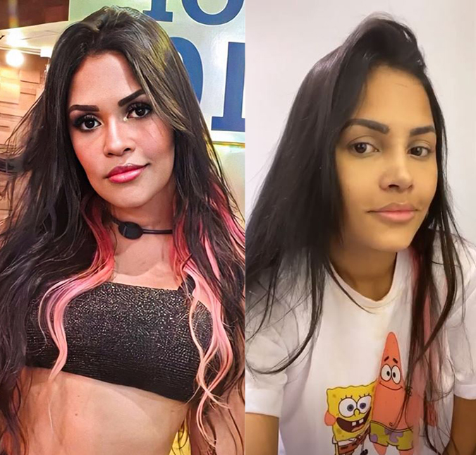 Flayslane retira curativos e mostra pela primeira vez resultado da rinoplastia; compare!
