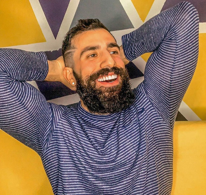 Kaysar Dadour passa por cirurgia no nariz e declara: <i>- Melhor dia do mundo</i>