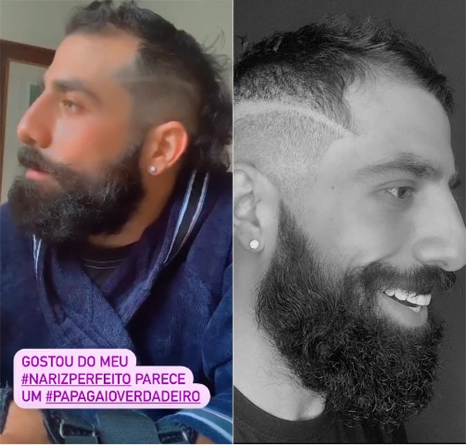 Kaysar Dadour mostra o nariz após cirurgia e nega plástica: <i>Continua igual papagaio</i>