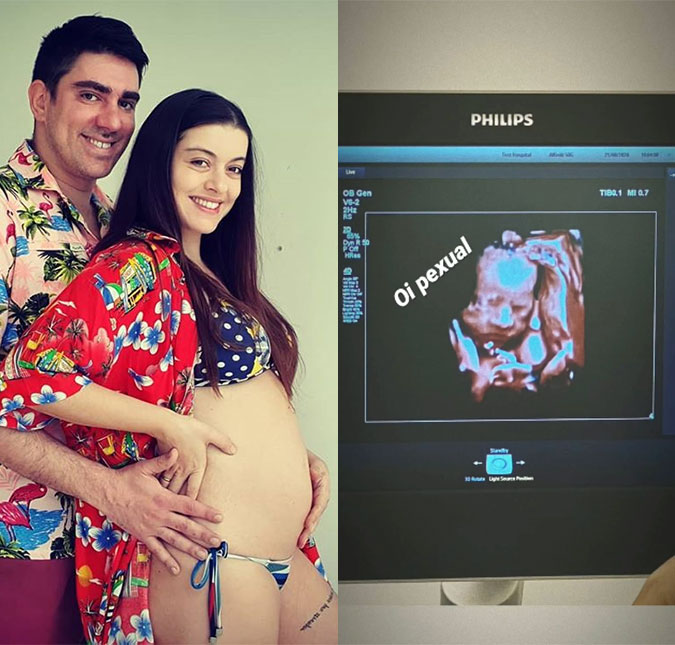 Esposa de Marcelo Adnet, Patricia Cardoso exibe rostinho da filha em ultrassom: <I>Oi, pexual</I>
