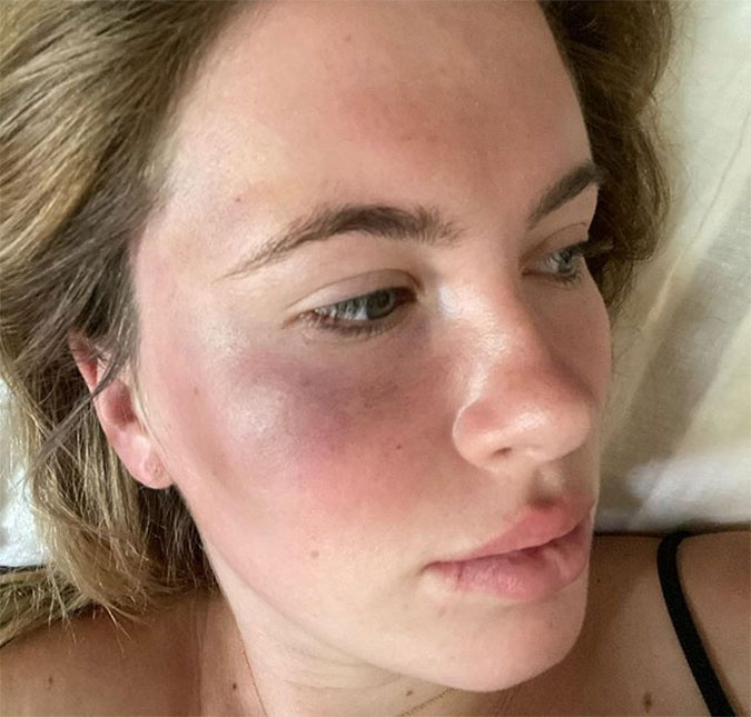 Filha de Alec Baldwin é agredida e roubada por desconhecida: <I>Ela estava fora de si, drogada e desesperada por dinheiro</I>