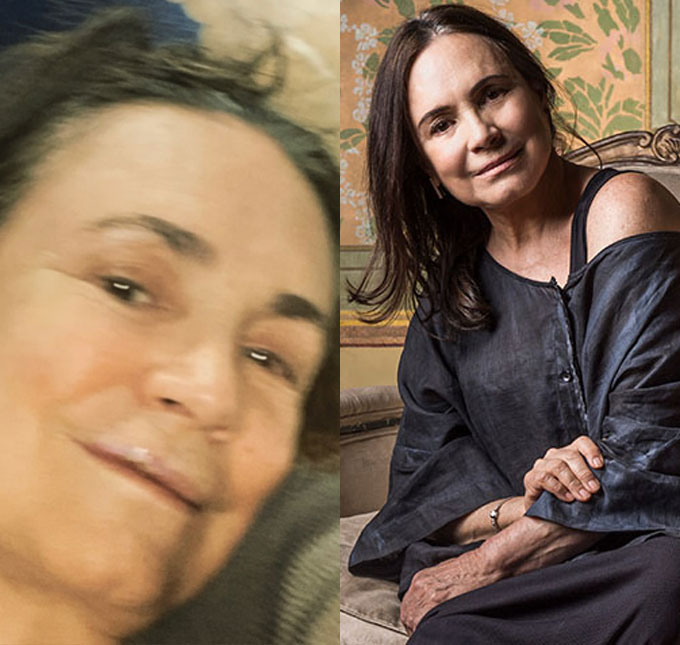 Regina Duarte faz cirurgia após quebrar três dentes ao cair em calçada: <i>Fui de boca no chão</i>