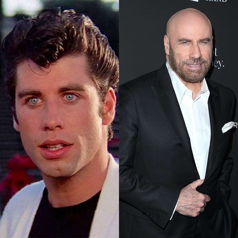Olivia NewtonJohn deixará saudades! Veja como está o elenco de Grease