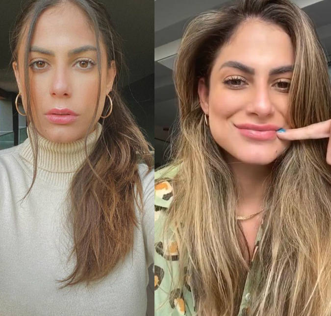 Mari Gonzalez faz preenchimento labial e mostra o resultado, veja!