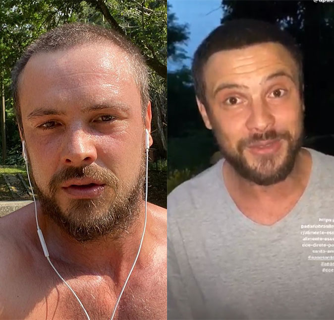 Sergio Guizé deixa resultado de transplante capilar à mostra nas redes sociais