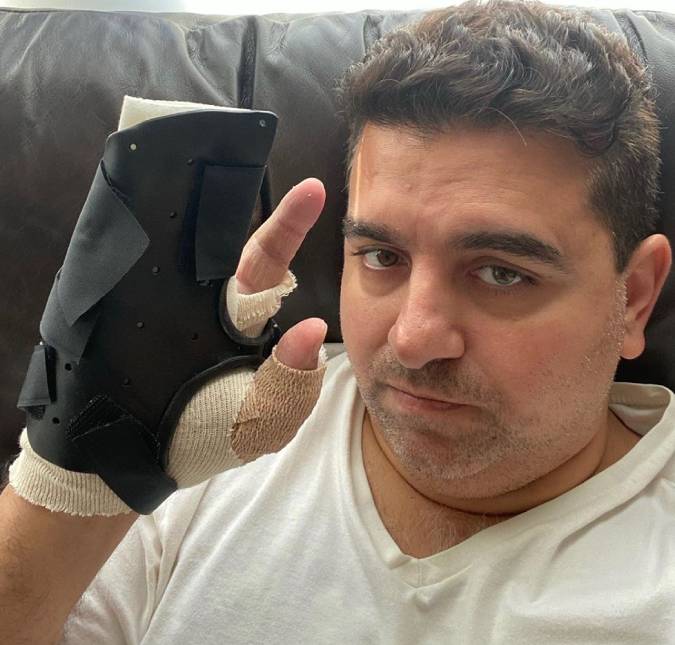Após acidente, Buddy Valastro passa pela terceira cirurgia na mão: <i>Tem sido um caminho difícil para a recuperação</i>