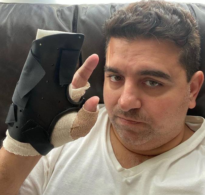 Após terceira cirurgia na mão, Buddy Valastro deve ser operado mais três vezes e desabafa: <i>- Dedos entorpecidos e rígidos</i>