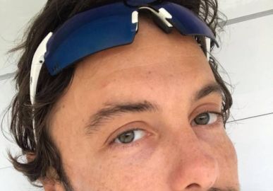 Kayky Brito aparece com machucado na testa após sofrer acidente inusitado!