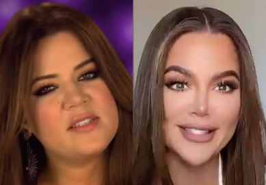 Khloé Kardashian surge irreconhecível em vídeo e assusta fãs: <i>O que aconteceu com seu nariz e queixo?</i>
