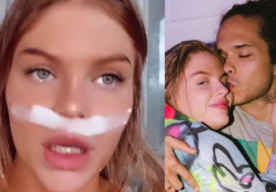 Luísa Sonza faz cirurgia no septo e recebe mimos do namorado, Vitão: <i>- Vou cantar melhor</i>
