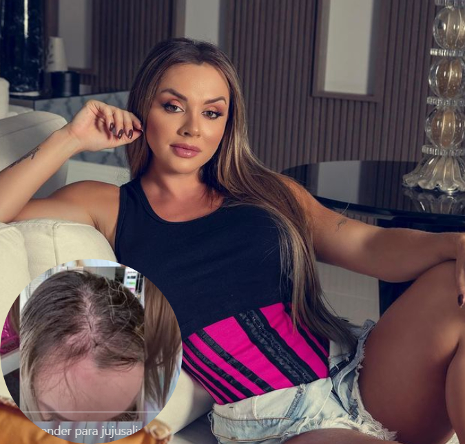 Juju Salimeni mostra queda de cabelo por depressão e impressiona os fãs